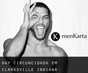 Gay Circuncidado em Clarksville (Indiana)